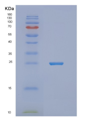 Recombinant Human NUDT16L1 Protein,Recombinant Human NUDT16L1 Protein