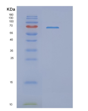 Recombinant Human NRF2 Protein,Recombinant Human NRF2 Protein