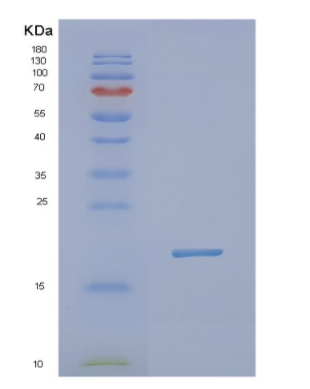 Recombinant Human NXT1 Protein,Recombinant Human NXT1 Protein