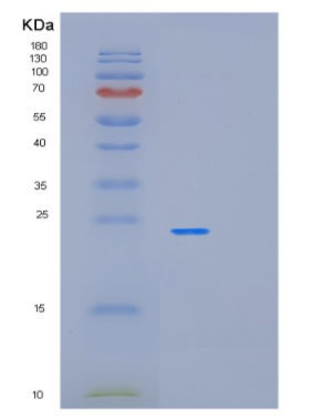 Recombinant Human OLR1 Protein,Recombinant Human OLR1 Protein