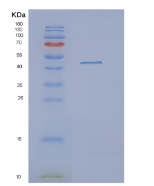 Recombinant Human OAT Protein,Recombinant Human OAT Protein