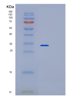 Recombinant Human OSR2 Protein,Recombinant Human OSR2 Protein