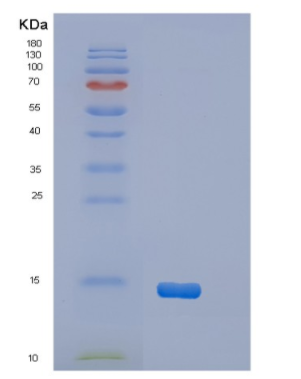 Recombinant Human OSTN Protein,Recombinant Human OSTN Protein