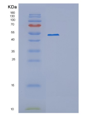 Recombinant Human OXSM Protein,Recombinant Human OXSM Protein