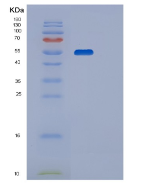 Recombinant Human P4HB Protein,Recombinant Human P4HB Protein