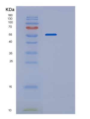 Recombinant Mouse P4HB Protein,Recombinant Mouse P4HB Protein