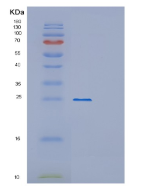 Recombinant Human OVCA2 Protein,Recombinant Human OVCA2 Protein