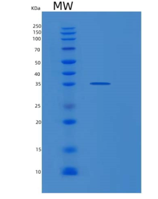 Recombinant Human PECR Protein,Recombinant Human PECR Protein