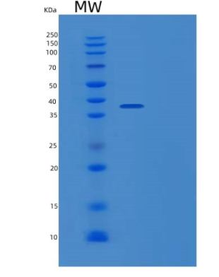 Recombinant Human PDXK Protein,Recombinant Human PDXK Protein