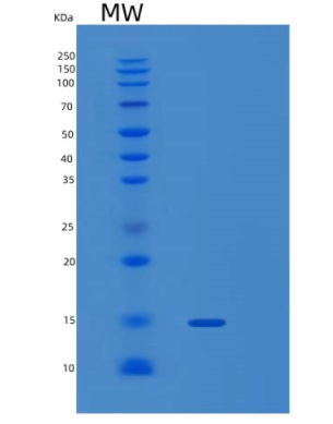 Recombinant Human PEA-15 Protein,Recombinant Human PEA-15 Protein