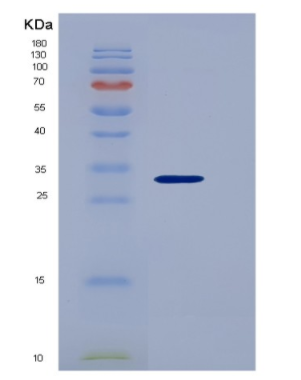 Recombinant Platelet Derived Growth Factor Subunit B (PDGFB),Recombinant Platelet Derived Growth Factor Subunit B (PDGFB)