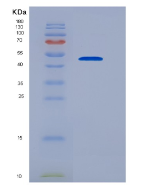 Recombinant Platelet Derived Growth Factor D (PDGFD),Recombinant Platelet Derived Growth Factor D (PDGFD)