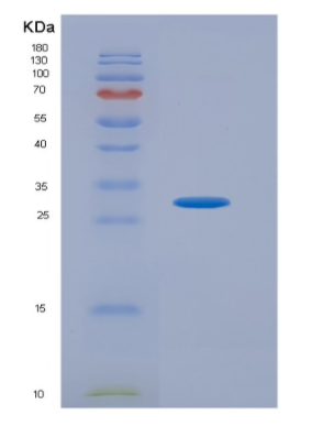 Recombinant Platelet Derived Growth Factor Receptor Alpha (PDGFRa),Recombinant Platelet Derived Growth Factor Receptor Alpha (PDGFRa)