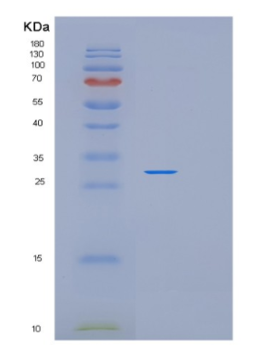 Recombinant Human PDCL3 Protein,Recombinant Human PDCL3 Protein