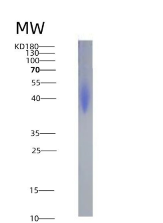 Eukaryotic Programmed Cell Death Protein 1 Ligand 2 (PDL2),Eukaryotic Programmed Cell Death Protein 1 Ligand 2 (PDL2)