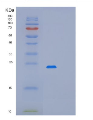 Recombinant Programmed Cell Death Protein 6 (PDCD6),Recombinant Programmed Cell Death Protein 6 (PDCD6)