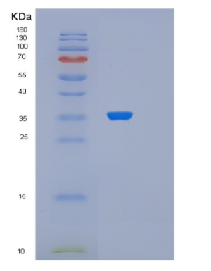 Recombinant Human PDCL Protein,Recombinant Human PDCL Protein