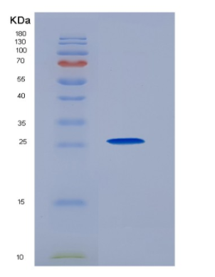 Recombinant Programmed Cell Death Protein 1 Ligand 2 (PDL2),Recombinant Programmed Cell Death Protein 1 Ligand 2 (PDL2)