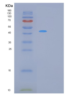 Recombinant Human PCOLCE Protein,Recombinant Human PCOLCE Protein