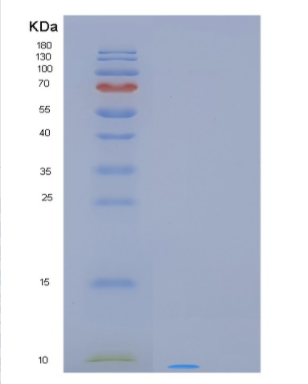 Recombinant Human PCP4L1 Protein,Recombinant Human PCP4L1 Protein