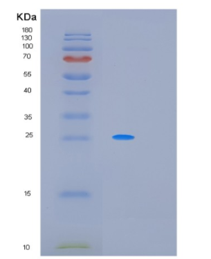 Recombinant Human PCSK1N Protein,Recombinant Human PCSK1N Protein