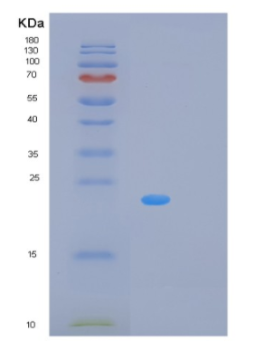 Recombinant Human PCNP Protein,Recombinant Human PCNP Protein