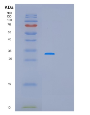 Recombinant Human PCNA Protein,Recombinant Human PCNA Protein