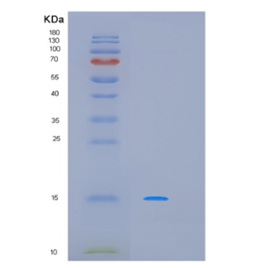 Recombinant Human MIEN1 Protein,Recombinant Human MIEN1 Protein