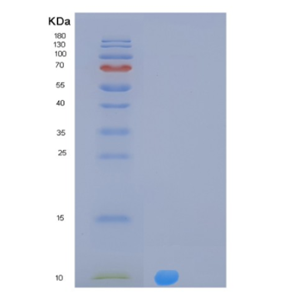 Recombinant Human MLANA Protein,Recombinant Human MLANA Protein