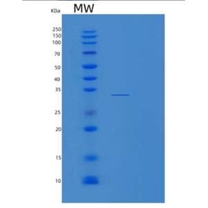 Recombinant Human MMADHC Protein,Recombinant Human MMADHC Protein