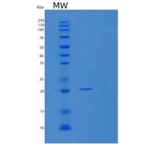 Recombinant Human MMP23B Protein,Recombinant Human MMP23B Protein