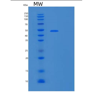 Recombinant Human MMP28 Protein,Recombinant Human MMP28 Protein