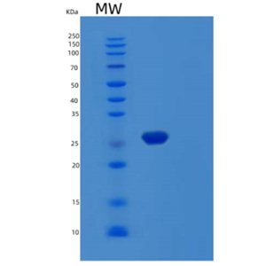 Recombinant Human MOB3B Protein,Recombinant Human MOB3B Protein