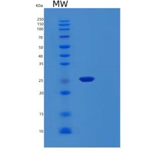 Recombinant Human MOBKL1B Protein,Recombinant Human MOBKL1B Protein