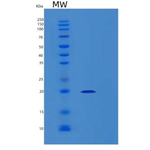 Recombinant Human MOSPD1 Protein