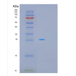 Recombinant Human MRAS Protein