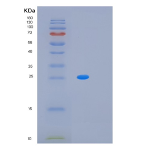 Recombinant Human MRGBP Protein,Recombinant Human MRGBP Protein