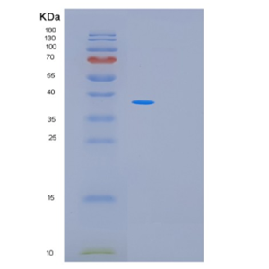 Recombinant Human MRM1 Protein,Recombinant Human MRM1 Protein