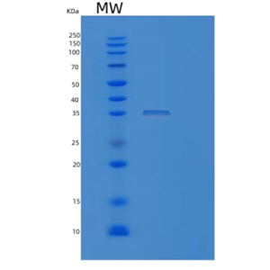 Recombinant Human MRPS2 Protein,Recombinant Human MRPS2 Protein