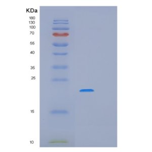 Recombinant Human MRPS25 Protein