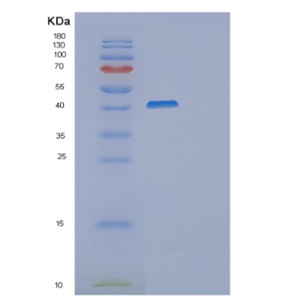 Recombinant Human MSR1 Protein