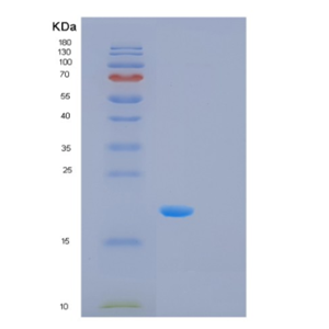 Recombinant Human MSRB2 Protein,Recombinant Human MSRB2 Protein