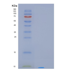 Recombinant Human MT3 Protein