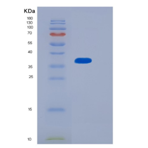 Recombinant Human MTHFD2 Protein