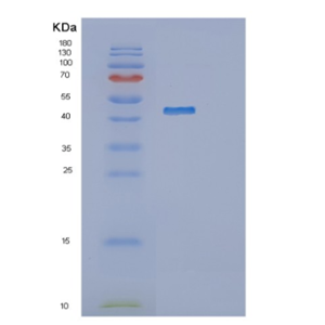 Recombinant Human MTHFSD Protein,Recombinant Human MTHFSD Protein