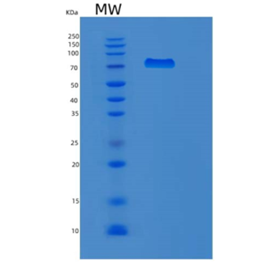 Recombinant Human MX1 Protein