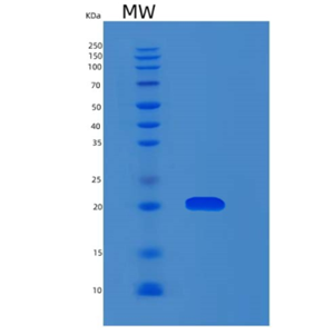 Recombinant Human MYL12A Protein,Recombinant Human MYL12A Protein