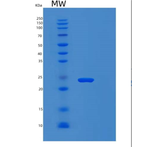 Recombinant Human MYL12B Protein,Recombinant Human MYL12B Protein