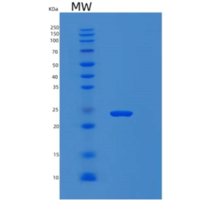 Recombinant Human MYL4 Protein