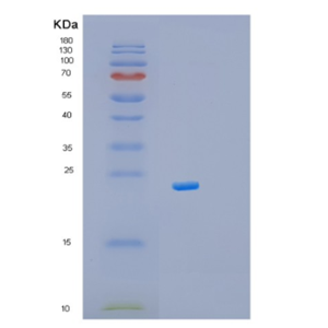 Recombinant Mouse Myl9 Protein